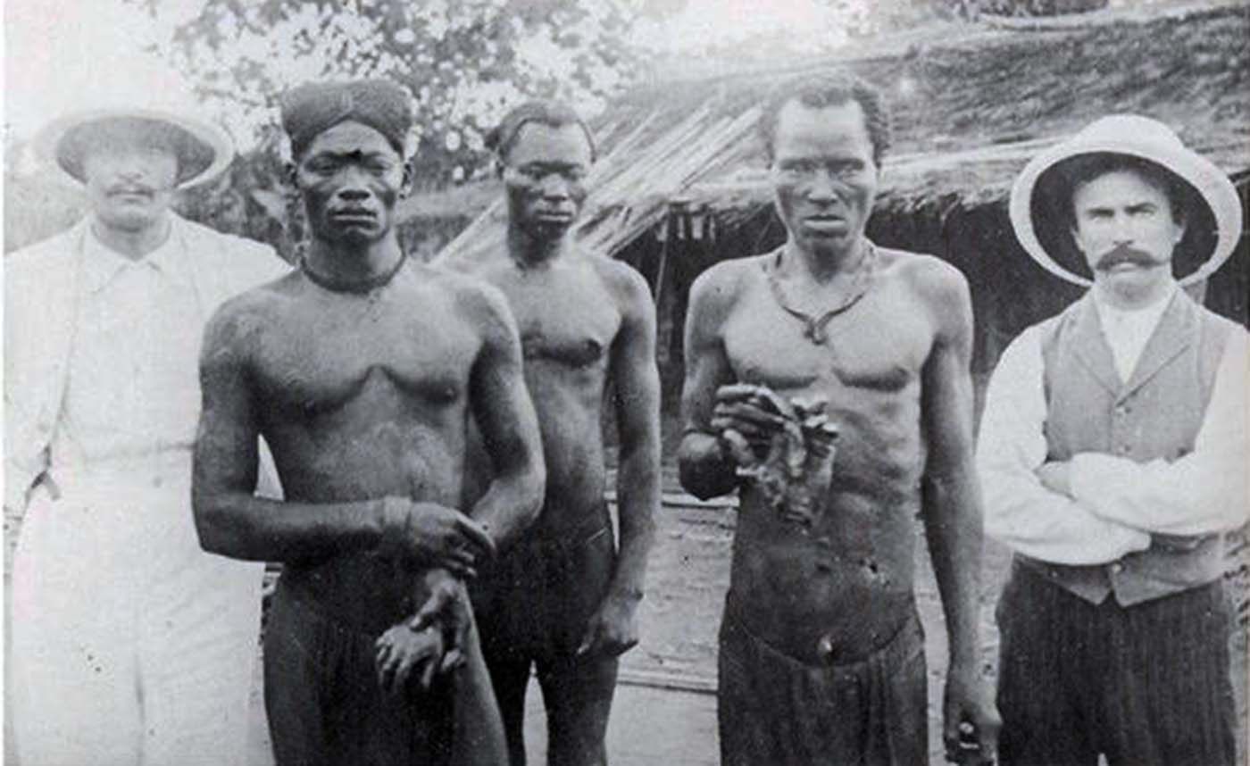 The forgotten genocide in the Congo.